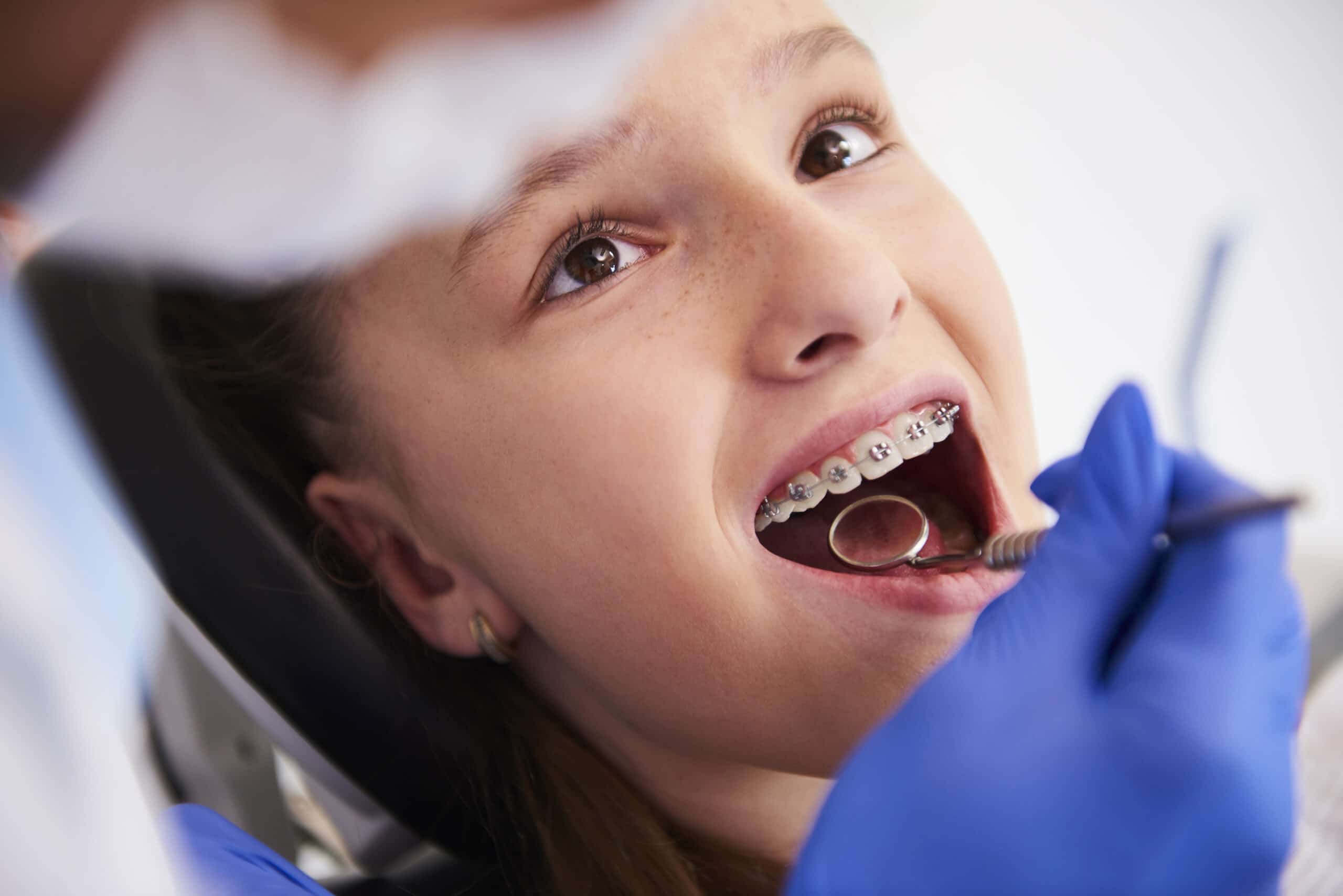 How much do braces cost? Ries Orthodontics
